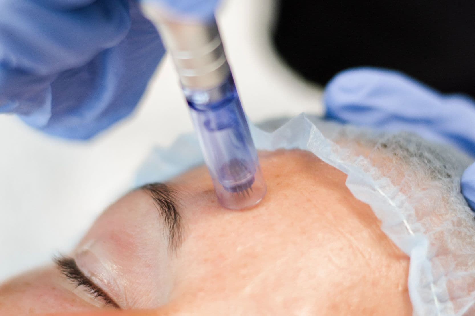 Image for Microneedle